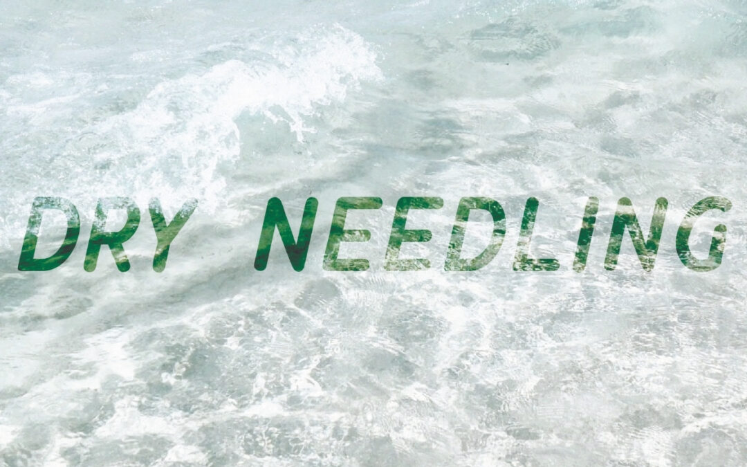Dry Needling…Is it For Me?